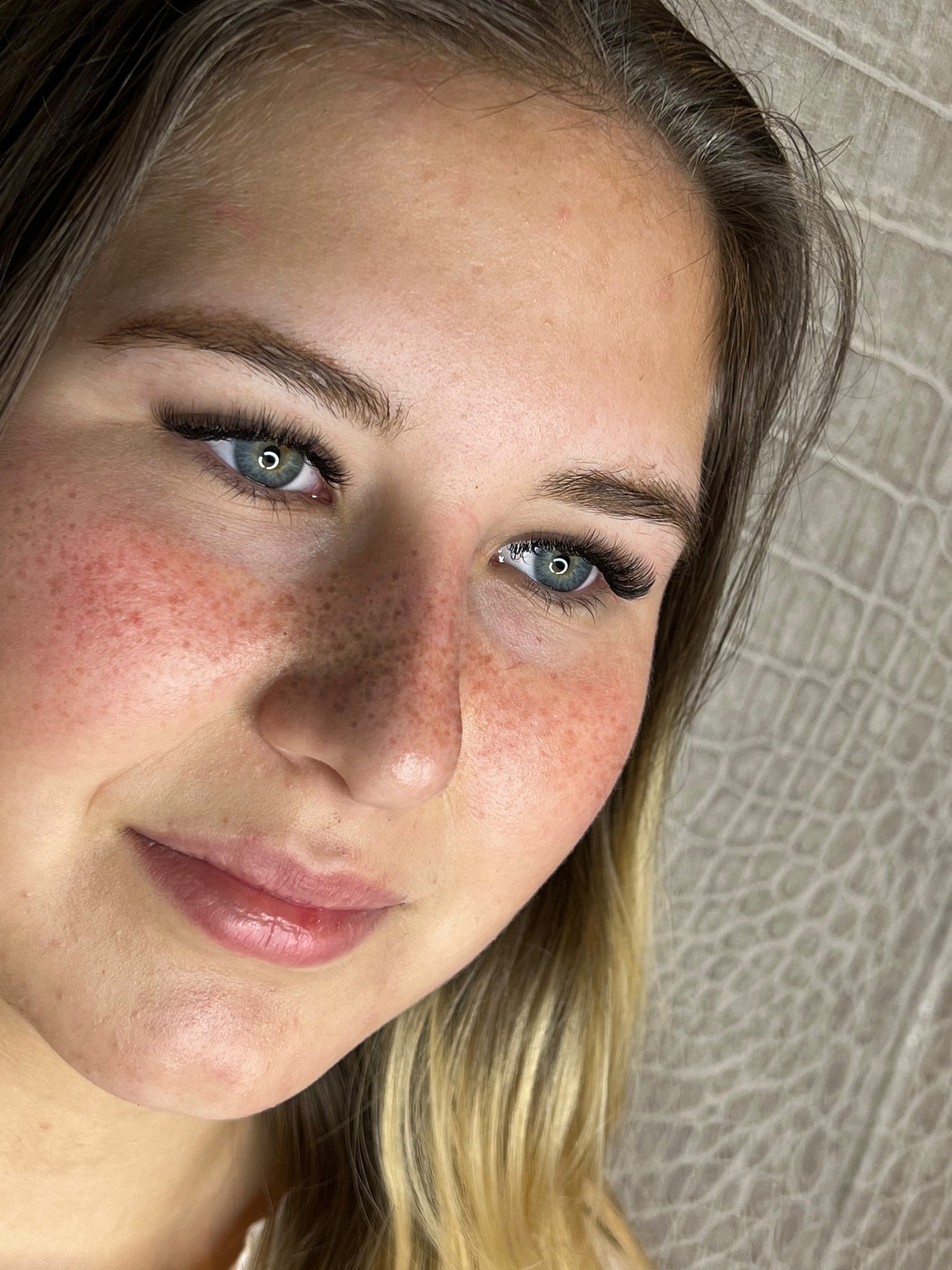 Sommersprossen Online Kurs inkl. Starterset & Zertifikat