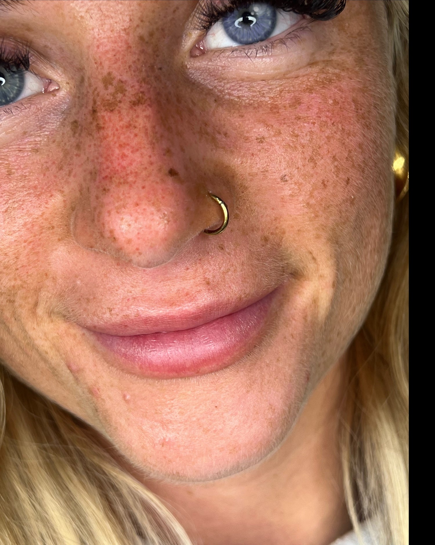 Sommersprossen Online Kurs inkl. Starterset & Zertifikat