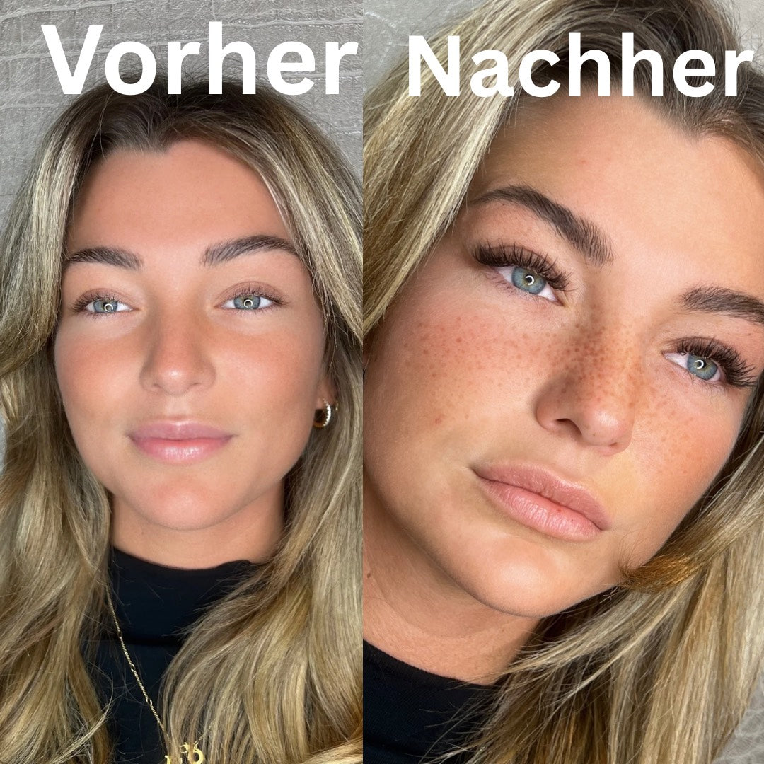 Sommersprossen Online Kurs inkl. Starterset & Zertifikat